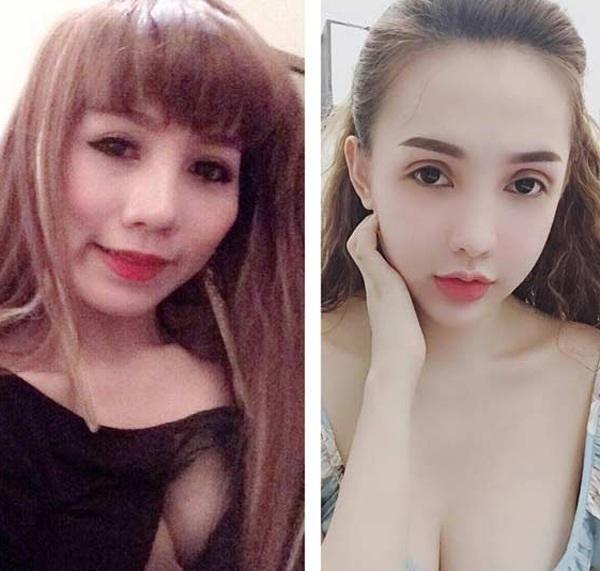 Chi 400 triệu thẩm mỹ thành hotgirl, 9X Sài Gòn giờ không dám mang bầu-1