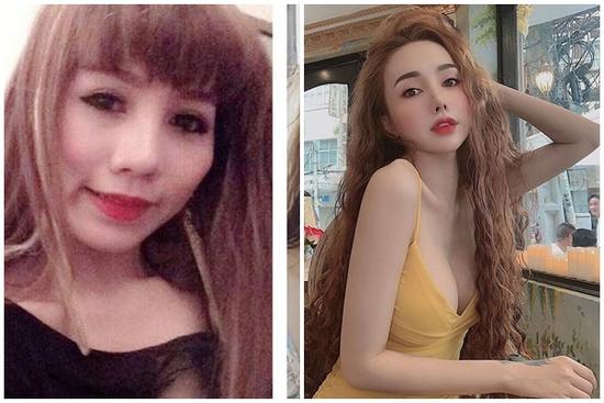 Chi 400 triệu thẩm mỹ thành hotgirl, 9X Sài Gòn giờ không dám mang bầu