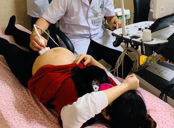 Thai phụ có thể phát hiện dị tật dính liền như cặp Song Nhi ngay từ 8 – 9 tuần thai-1