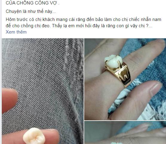 Ngủ vẫn gọi tên tình cũ, chồng bị vợ tát rụng răng còn mang đi làm một việc khiến ai nấy cười bò-1