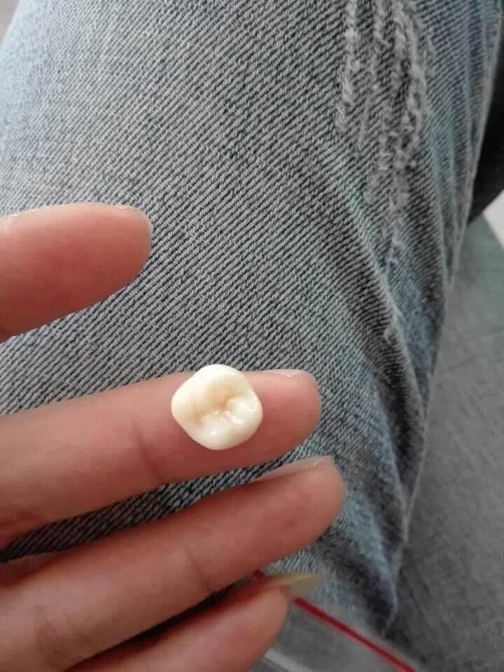 Ngủ vẫn gọi tên tình cũ, chồng bị vợ tát rụng răng còn mang đi làm một việc khiến ai nấy cười bò-2