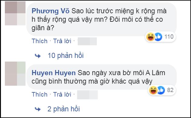 Giật mình đôi môi Lê Dương Bảo Lâm, dao kéo xong còn xấu hơn thời da đen mặt mụn-3