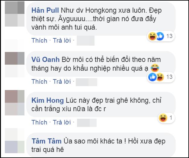 Giật mình đôi môi Lê Dương Bảo Lâm, dao kéo xong còn xấu hơn thời da đen mặt mụn-4