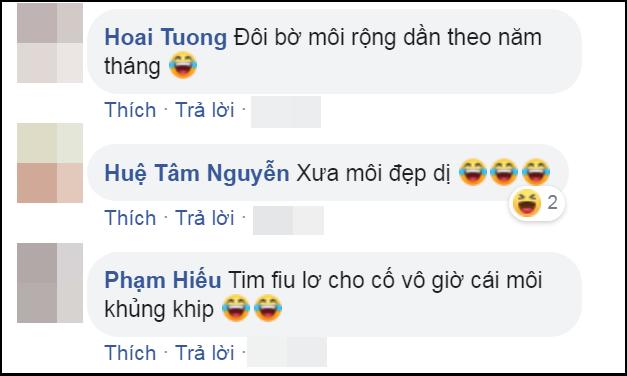 Giật mình đôi môi Lê Dương Bảo Lâm, dao kéo xong còn xấu hơn thời da đen mặt mụn-5