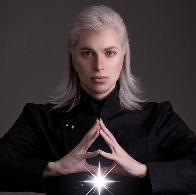 Với đôi tai nhọn hoắt, mắt to và mái tóc bạch kim, Luis Padron (26 tuổi, Argentina) khiến nhiều người chú ý mỗi khi xuất hiện ngoài đường.