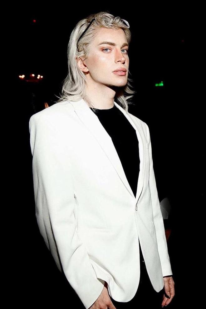 Đây là kết quả của quá trình biến đổi ngoại hình để trông giống Pleiadian - sinh vật được cho lai giữa yêu tinh và người ngoài hành tinh - của anh suốt 5 năm qua.