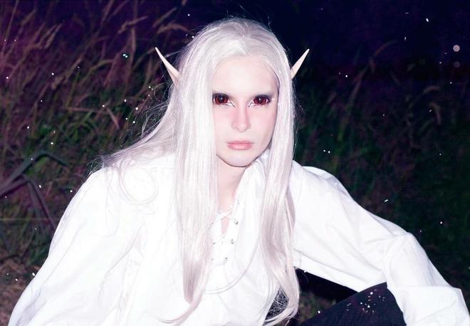 “Tôi trải qua gần 40 ca phẫu thuật lớn nhỏ. Tôi đã chi khoảng 60.000 USD cho việc này”, Luis cho hay. Trong 5 năm qua, “hoàng tử dao kéo” đã phẫu thuật thay đổi màu mắt 6 lần, 2 lần sửa mũi, tiêm filler và tạo hình chóp tai để giống yêu tinh. Gần đây nhất, Luis tới Hàn Quốc phẫu thuật để có bộ hàm giống nhân vật trong anime.