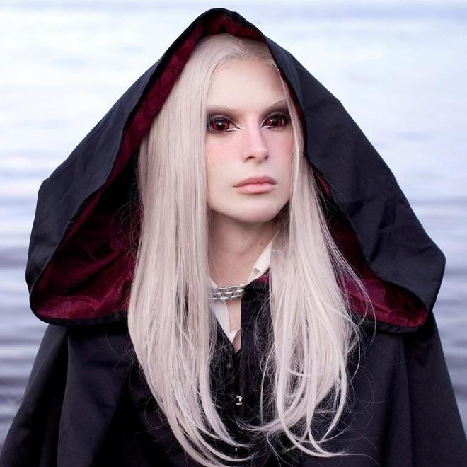 “Họ cắt xương hàm thành 4 phần, sau đó bỏ đi 1 phần nhỏ khỏi xương. Họ gắn chúng lại sao cho hình dáng trông góc cạnh như một viên kim cương. Sau phẫu thuật, tôi phải ăn đồ lỏng trong một tháng trời. Điều này thật khó khăn vì tôi rất thích ăn”, Luis kể.