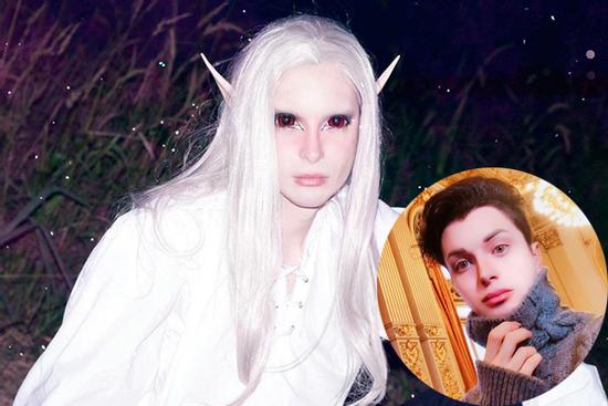 Chi 60.000 USD, phẫu thuật 32 lần để thành ‘yêu tinh đời thực’