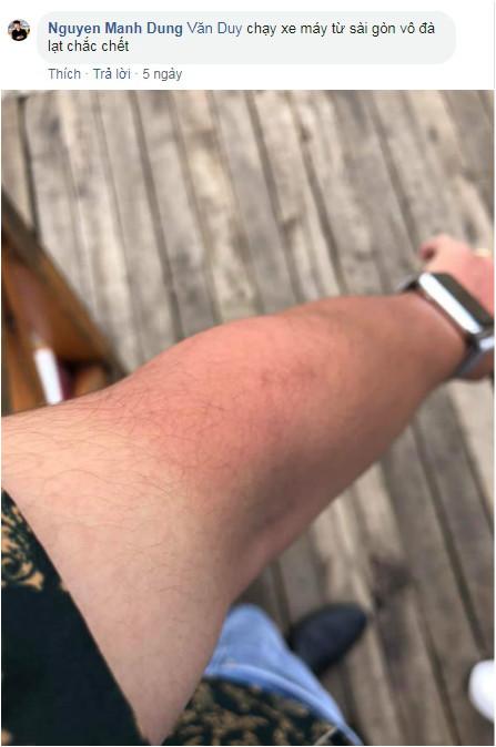 Dưỡng trắng 3 năm, cháy 1 giờ của những con giời trở về sau mùa du lịch-1