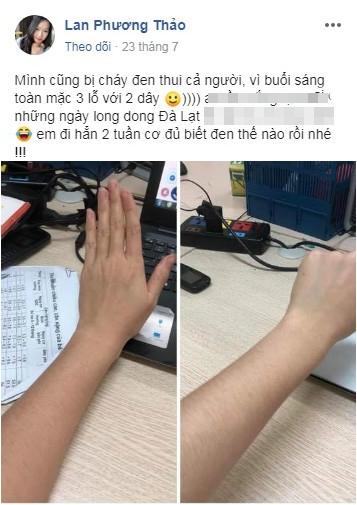 Dưỡng trắng 3 năm, cháy 1 giờ của những con giời trở về sau mùa du lịch-4