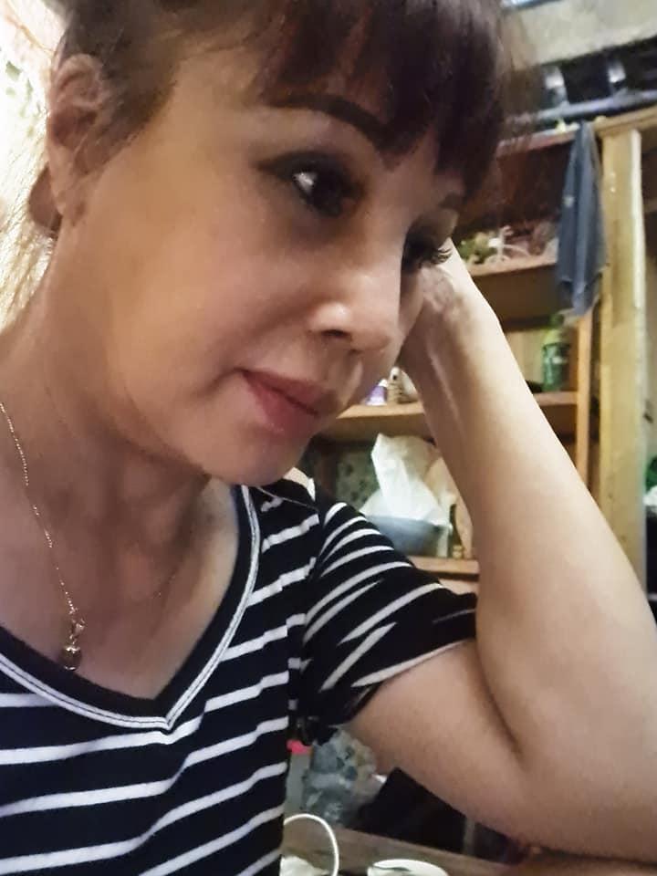 Hơn 1 tháng sau dao kéo, gương mặt cô dâu 63 tuổi ở Cao Bằng vẫn méo lệch-3