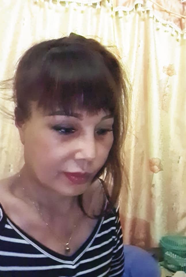 Hơn 1 tháng sau dao kéo, gương mặt cô dâu 63 tuổi ở Cao Bằng vẫn méo lệch-4