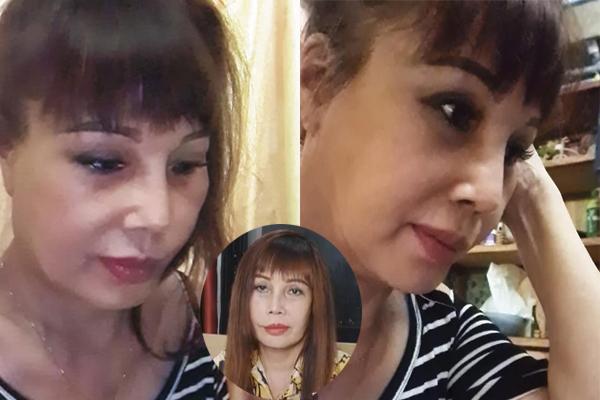 Hội gái xinh công khai tường tận quá trình dao kéo, đẹp hay không chưa bàn nhưng ai cũng quá can đảm-16