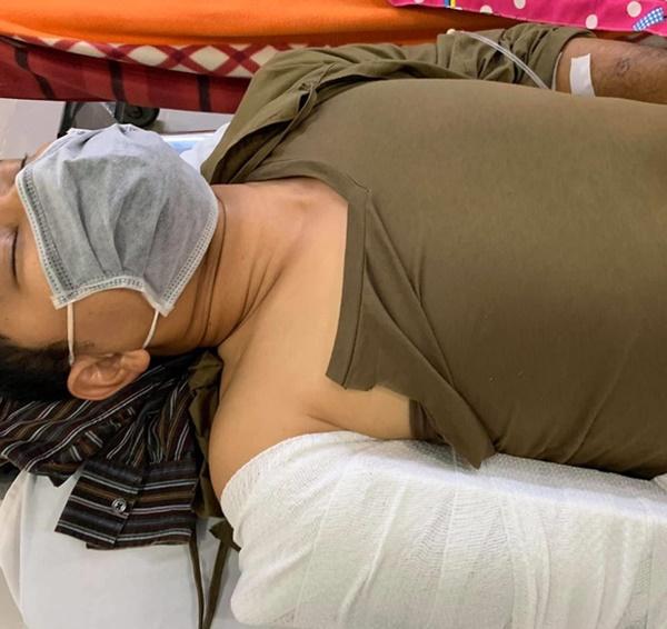 Huỳnh Đông gặp tai nạn gãy xương ống tay khi quay phim-2