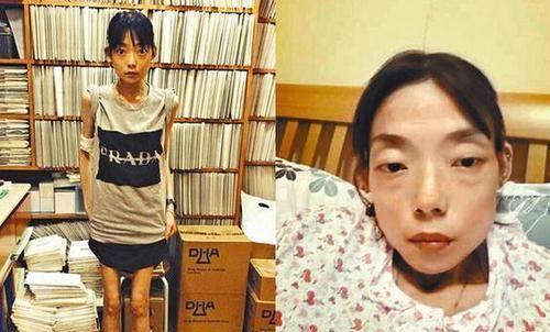 Mỹ nhân Hong Kong giảm cân khắc nghiệt, chỉ còn 22kg nhăn như trái táo khô-3