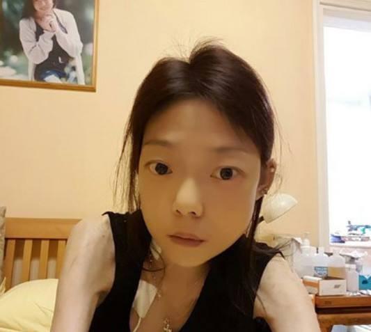 Mỹ nhân Hong Kong giảm cân khắc nghiệt, chỉ còn 22kg nhăn như trái táo khô-5