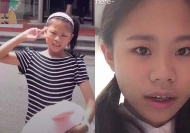 Cô gái phẫu thuật thẩm mỹ từ năm 13 tuổi, 3 năm 60 lần dao kéo giờ ra sao?-2