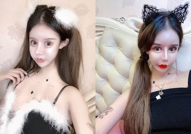 Cô gái phẫu thuật thẩm mỹ từ năm 13 tuổi, 3 năm 60 lần dao kéo giờ ra sao?-4