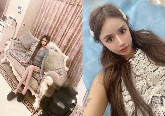 Cô gái phẫu thuật thẩm mỹ từ năm 13 tuổi, 3 năm 60 lần dao kéo giờ ra sao?-5