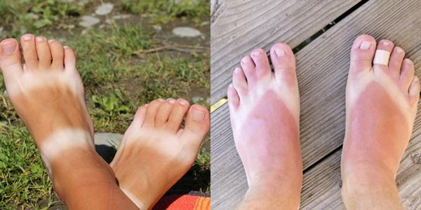 Cười thả ga với màn dưỡng trắng 3 năm cháy đen 1 giờ vận vào em bé siêu đáng yêu-4