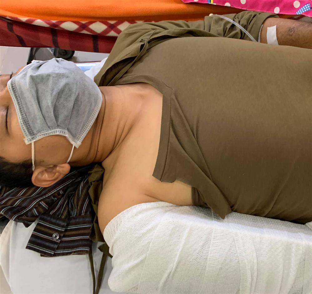 Sao Việt liên tiếp gặp tai nạn: Huỳnh Đông gãy tay, Thanh Bình vỡ sụn gối-1