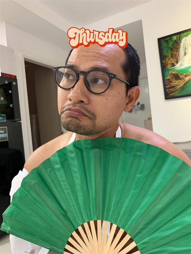 Sao Việt liên tiếp gặp tai nạn: Huỳnh Đông gãy tay, Thanh Bình vỡ sụn gối-4