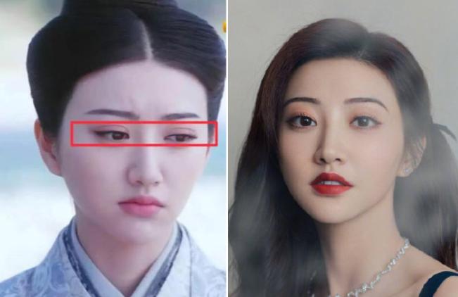 Cảnh Điềm bị chê giống ếch khi công khai thẩm mỹ hỏng-1