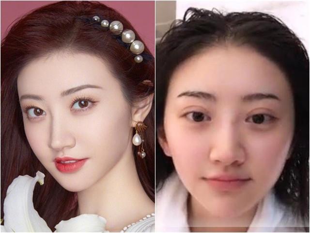 Cảnh Điềm bị chê giống ếch khi công khai thẩm mỹ hỏng-4