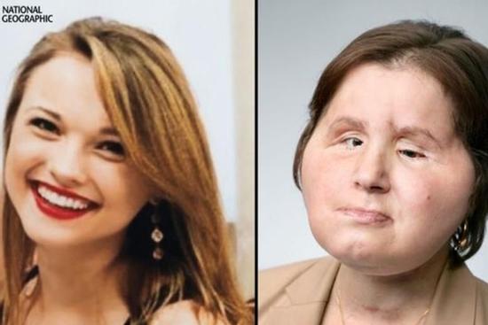 Những ca ghép mặt khiến cả thế giới sửng sốt