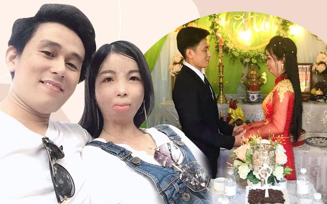 Câu chuyện đằng sau bức ảnh ông chồng điển trai và cô vợ biến dạng khuôn mặt-1