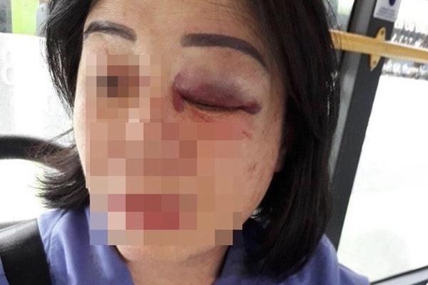 Công an vào cuộc vụ nhân viên xe buýt ở TP.HCM bị tấn công-1