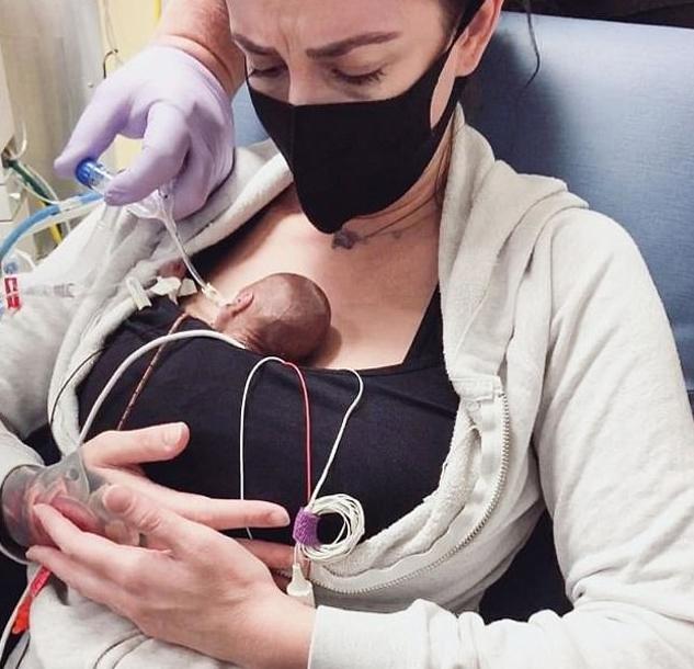 Cặp song sinh chào đời chỉ nặng 0,5kg, dài bằng gang tay bố hiện giờ thế nào?-3