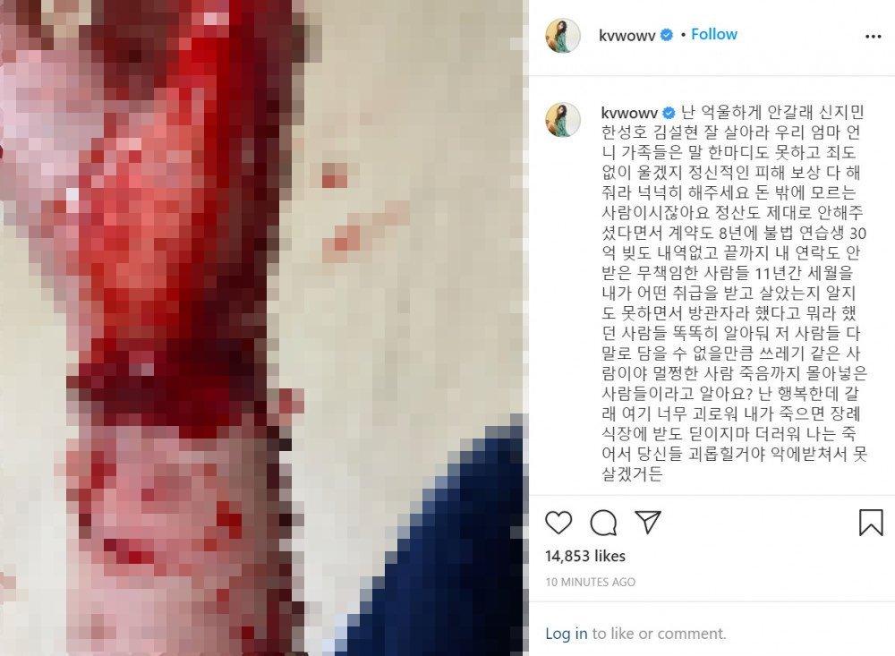 AOA Mina đăng ảnh cổ tay đầy máu, nhập viện khẩn cấp trong đêm-2