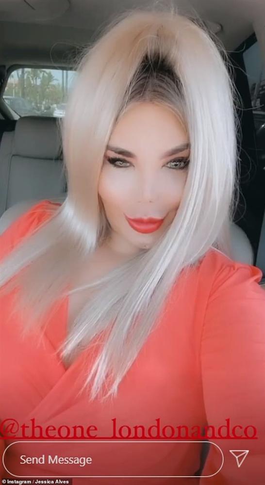 Búp bê Ken đời thực khiến netizen sốc nặng vì body méo mó dị thường, kéo đến ảnh cận mặt mà muốn ngất-6