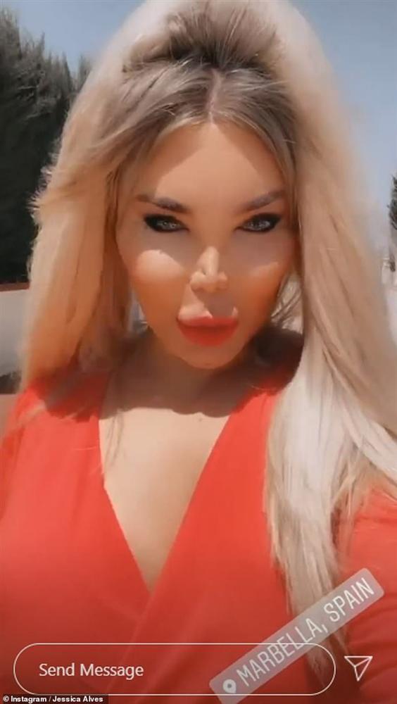 Búp bê Ken đời thực khiến netizen sốc nặng vì body méo mó dị thường, kéo đến ảnh cận mặt mà muốn ngất-7