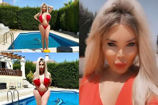 'Búp bê Ken' đời thực khiến netizen sốc nặng vì body méo mó dị thường, kéo đến ảnh cận mặt mà muốn ngất