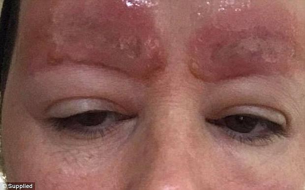 Chi 25 triệu đồng xăm chân mày, người phụ nữ nhận về 2 con sâu róm chói lọi, lên mạng kêu than còn bị kiện ngược lại hơn 3 tỷ đồng-3