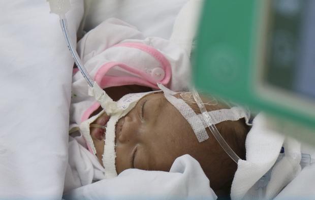TP.HCM: Xót xa bé trai sơ sinh bệnh nặng bị cha mẹ bỏ rơi, bàn tay yếu ớt bấu chặt giường bệnh tìm sự sống-3