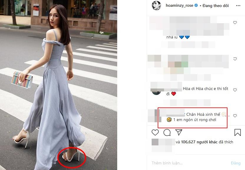 Hòa Minzy bị chê bàn chân xấu để ngón tràn ra rong chơi lề đường-2