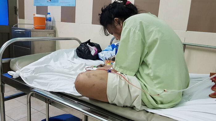 Nhóm thanh niên hành hung cô gái ở TP.HCM đến sảy thai-3