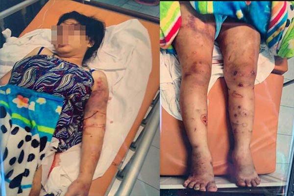 Không được cho ở nhờ, nam thanh niên trả thù đánh mẹ, bắt con-2