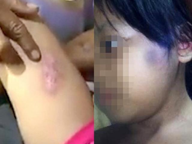 Xét xử gã cha dượng thú tính hành hung con riêng của vợ thương tật tới 47%-2