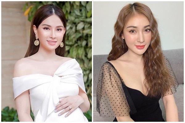 Thu Thủy sau phẫu thuật xinh thì có xinh nhưng nụ cười sao giống tượng sáp-9