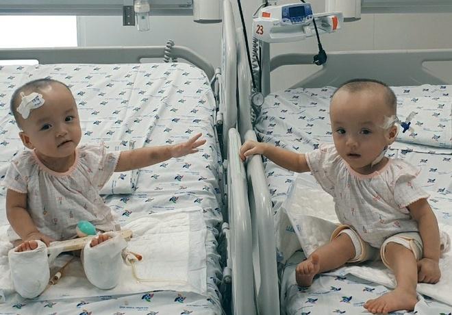 Song Nhi lần đầu chạm tay nhau sau ca mổ tách rời-1