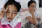 Hot girl Trang Anna bổ sung ca phẫu thuật hạ gò má vào bộ sưu tập 'đập mặt xây lại'