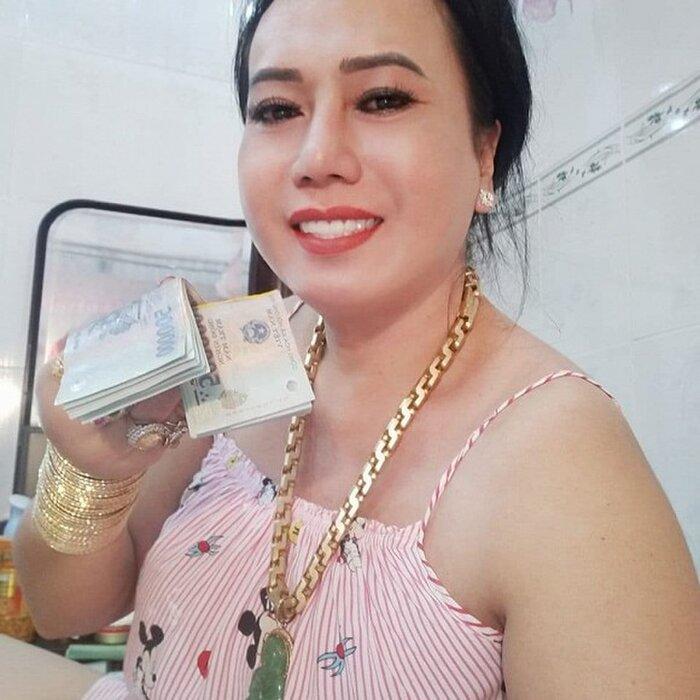 Cô Minh Hiếu khiến dân tình xôn xao khi công khai hình ảnh phẫu thuật thẩm mỹ-2