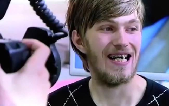 Những pha ở bẩn đến phát shock, có người tử vong chỉ vì lười tắm-3