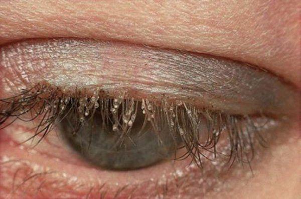 Những pha ở bẩn đến phát shock, có người tử vong chỉ vì lười tắm-4