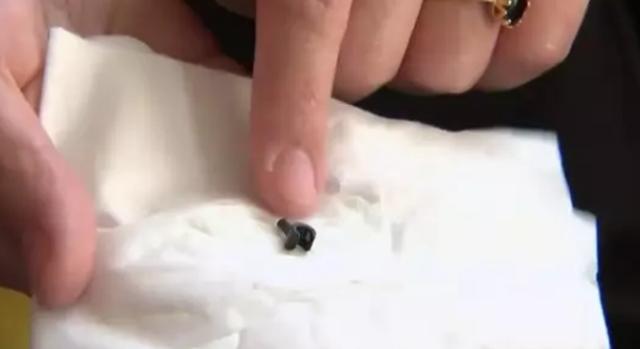 Tìm thấy mảnh ghép Lego chơi trốn tìm suốt 2 năm trong lỗ mũi cậu bé 7 tuổi-2